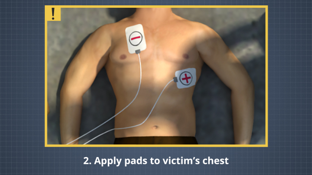 将每个两个垫放在受害者胸部的正确位置非常重要。