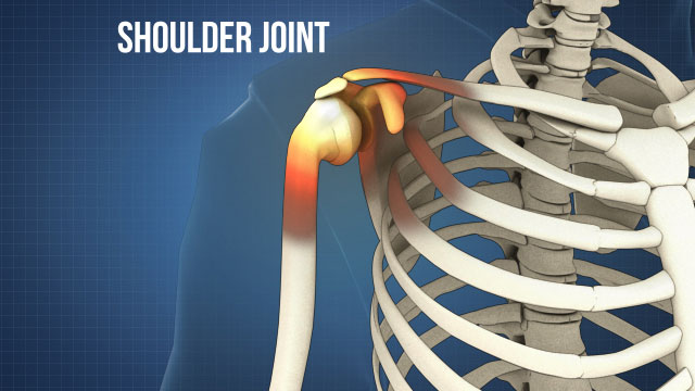 肩关节由五个关节和三个主要骨骼（肱骨、锁骨和肩胛骨）组成。